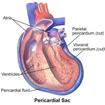 Pericardiectomy indications, procedure, complications, prognosis & long term effects