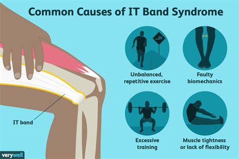 Iliotibial It Band Syndrome Causes Treatment More