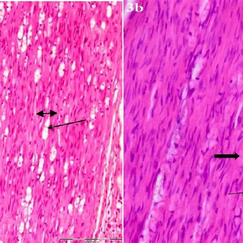 Histopathological Photographs Of Anastomosed Sciatic Nerve In CDA Group