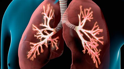 O Q É Enfisema Pulmonar - O que é Enfisema Pulmonar: Tratamento, Sintomas, Prevenção, Tipos e Mais