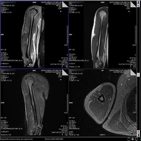 Resonancia Magnética Brazo Centro Médico Dr Serván