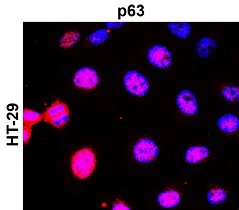 P Antibody Ir Ireal Biotechnology Inc