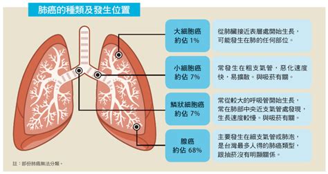 肺腺癌是什麼？一次了解肺腺癌症狀、治療以及如何預防 康健知識庫