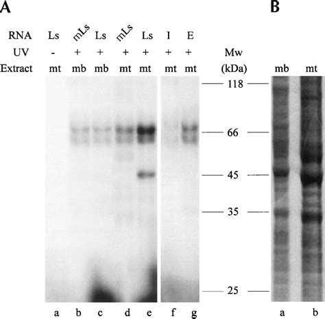 Perinuclear Localization Of Slow Troponin C M RNA In Muscle Cells Is