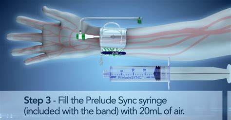 PreludeSYNC™ Radial Compression Device - Personal and Effective