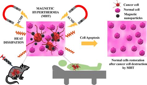 Review On Magnetic Nanoparticle Mediated Hyperthermia For Cancer