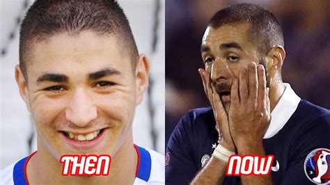 Karim Benzema Transformation Then And Now Hair Style And Teeth And Body