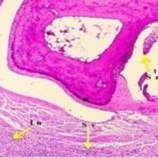 Histopathology Of The Ankle Joint Of Rat Treated With Standard