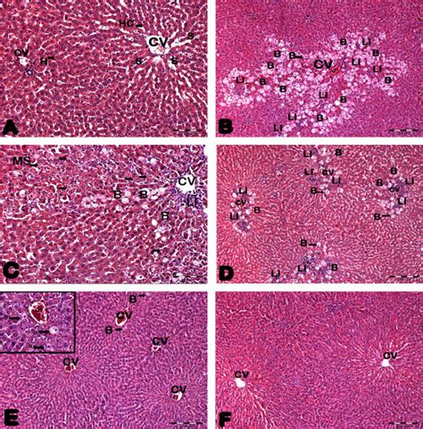 Effects Of Spe And Silymarin On Liver Histopathological Change In