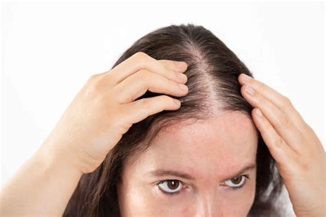 Thinning Hair And Female Hair Loss Causes Prevention Diagnosis And Treatment