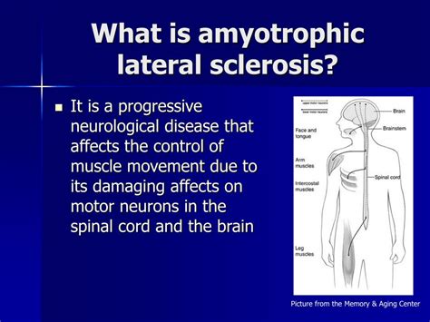 Ppt Amyotrophic Lateral Sclerosis Als Powerpoint Presentation Free