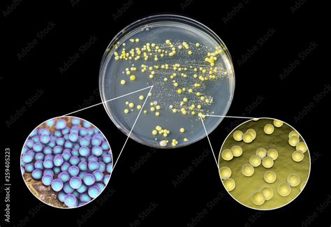 Colonies Of Bacteria Grown From Human Skin Smear Staphylococcus