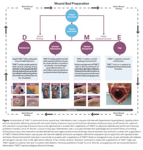 Topical Autologous Blood Clot Therapy Consensus Panel Recommendations