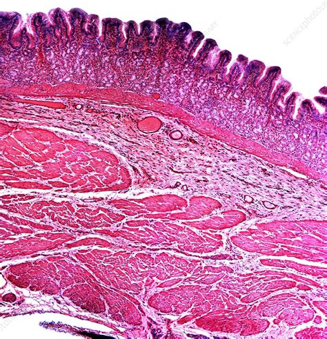 Small Intestine Section Light Micrograph Stock Image C