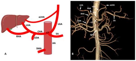 Diagnostics Free Full Text Importance Of Anatomical Variation Of