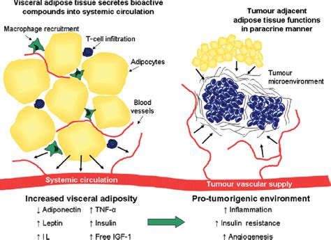 Colour Online Increased Visceral Adiposity Creates A Pro Tumorigenic