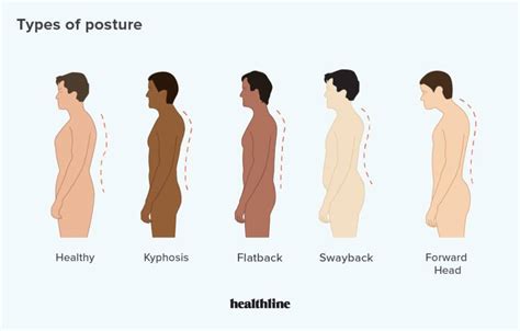 How To Correct Neck Posture At Enrique Ellinger Blog