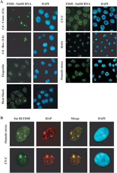 In Situ Hybridization Analysis Of Hela Cells Subjected To Different