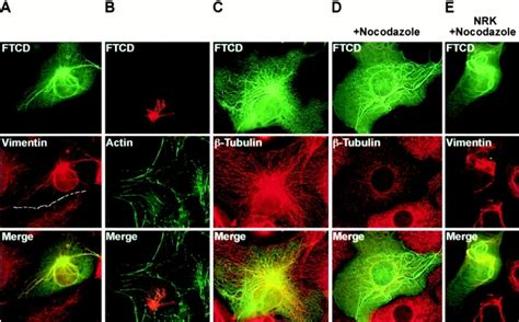 Ftcd Remodels The Vimentin If Cytoskeleton Independent Of The Actin And