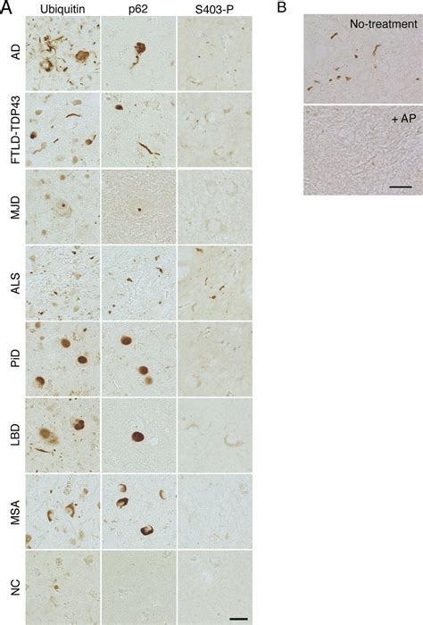 Immunohistochemical Staining Of Tissues From Neurodegenerative Diseases