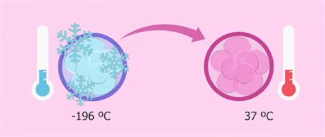 La Transferencia Diferida O Transferencia De Embriones Congelados