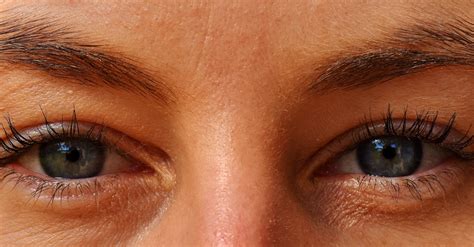 Poches sous les yeux Quels sont les soins du visage recommandés pour