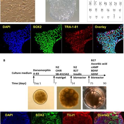 Generation Of Ipsc Derived Forebrain Organoids A Ipsc Generation Using