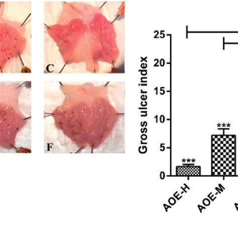 Gross Findings Of Indomethacin Induced Gastric Damage In The Rat