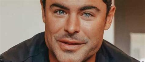 Zac Efron Se Desfiguró La Cara Mendoza Post