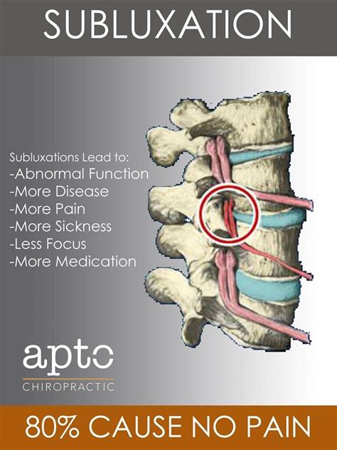 Chiropractic 101 The “what” Chiropractic Subluxation Medical