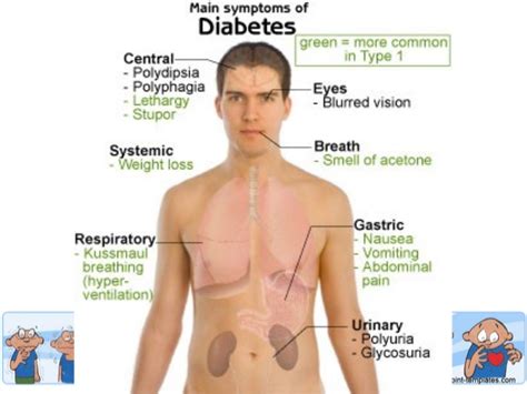 Gejala Diabetes Mellitus - Medicine Stuffs