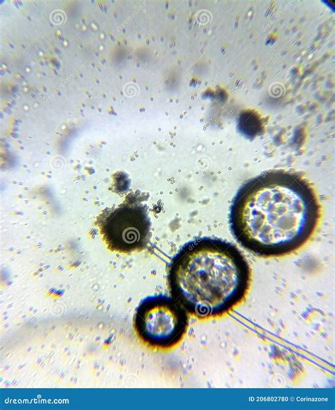 Aspergillus Niger the Black Mold Conidia Under the Microscope Stock ...