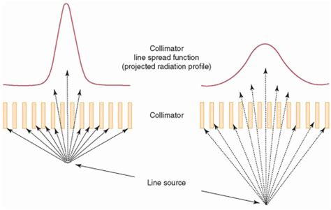 Nuclear Imaging—the Gamma Camera Radiology Key