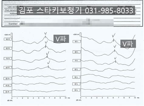 청각장애진단 유소아 신생아 청력검사 Abr Aabr 검사 스타키보청기 김포센터청각음향