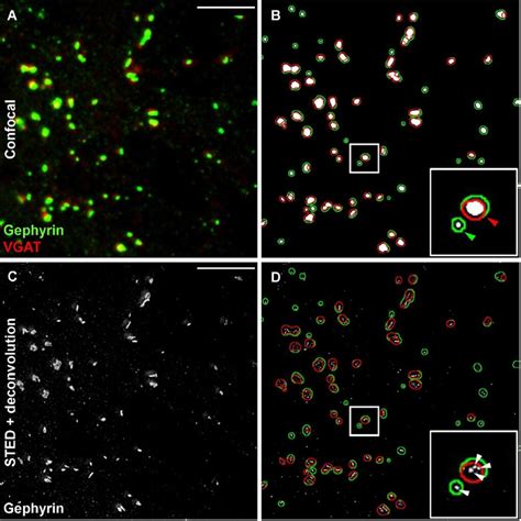 Mechanisms of neuronal plasticity - NeuroScienceLab