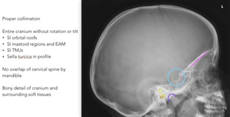 Radr Skull Evaluation Criteria Flashcards Quizlet