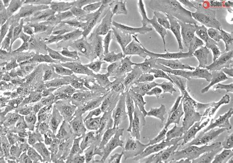 Human Non Pigment Ciliary Epithelial Cells HNPCEpiC