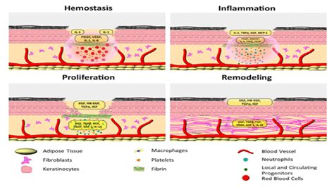 Stages Of Wound Healing Overview, Process Timeline Video, 45% OFF