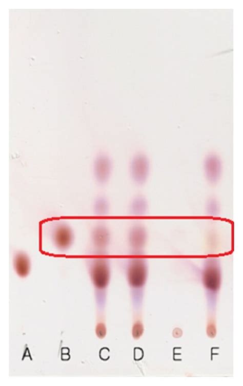 TLC Analysis Of GABA In The Culture Medium And Cytoplasmic Fraction Of