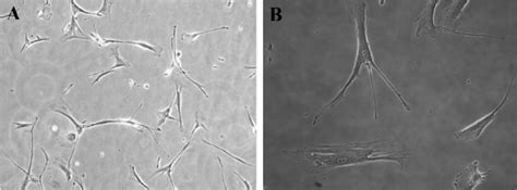 Human Gingival Fibroblasts Primary Cells A ×100 B ×200 Download