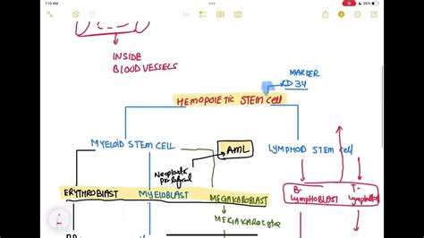 Leukemia Haematology 79 First Aid Usmle Step 1 In Urdu Hindi Youtube