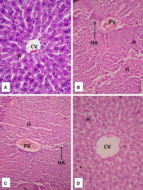 Microphotograph Of Liver Sections Stained With Hematoxylin And Eosin A