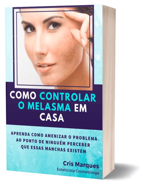 Como Controlar O Melasma Em Casa E Book Cris Marques