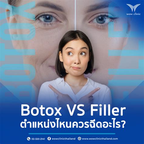 Botox Vs Filler Wow