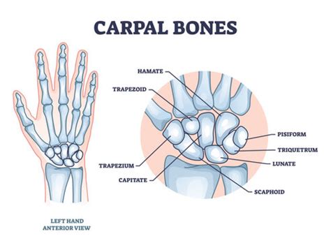 Right Hand Carpal Bones