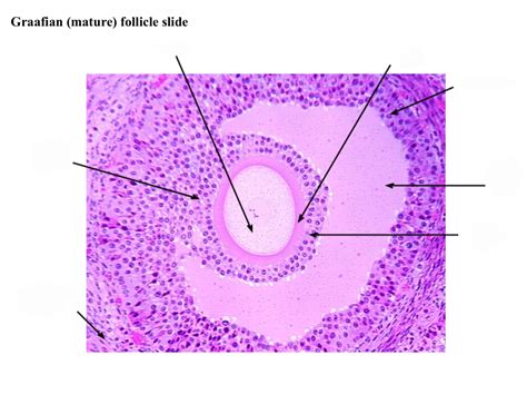 Graafian Follicle Slide Quiz