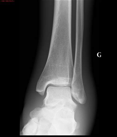 Radiology Quiz Radiopaedia Org