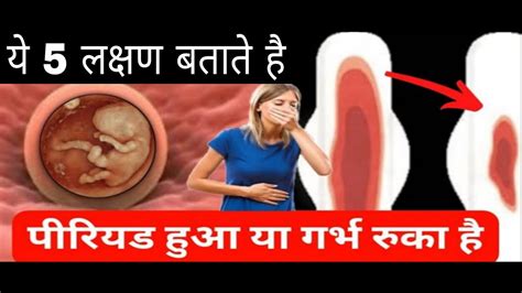 Early Pregnancy Symptoms 20 वे दिन ऐसा महसूस हो रहा है तो प्रेगनेंसी