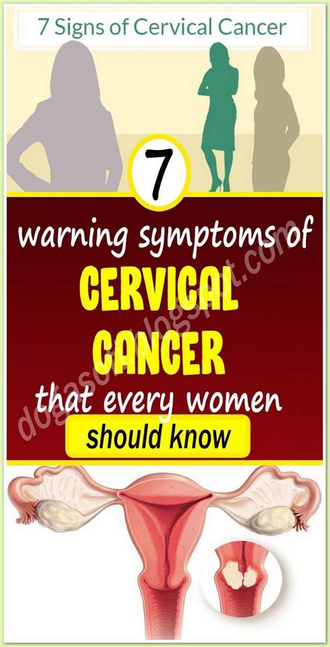 7 warning symptoms of cervical – Artofit