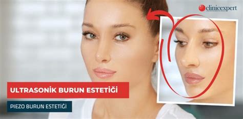 Piezo Burun Estetiği Ultrasonik Burun Estetiği Clinic Expert